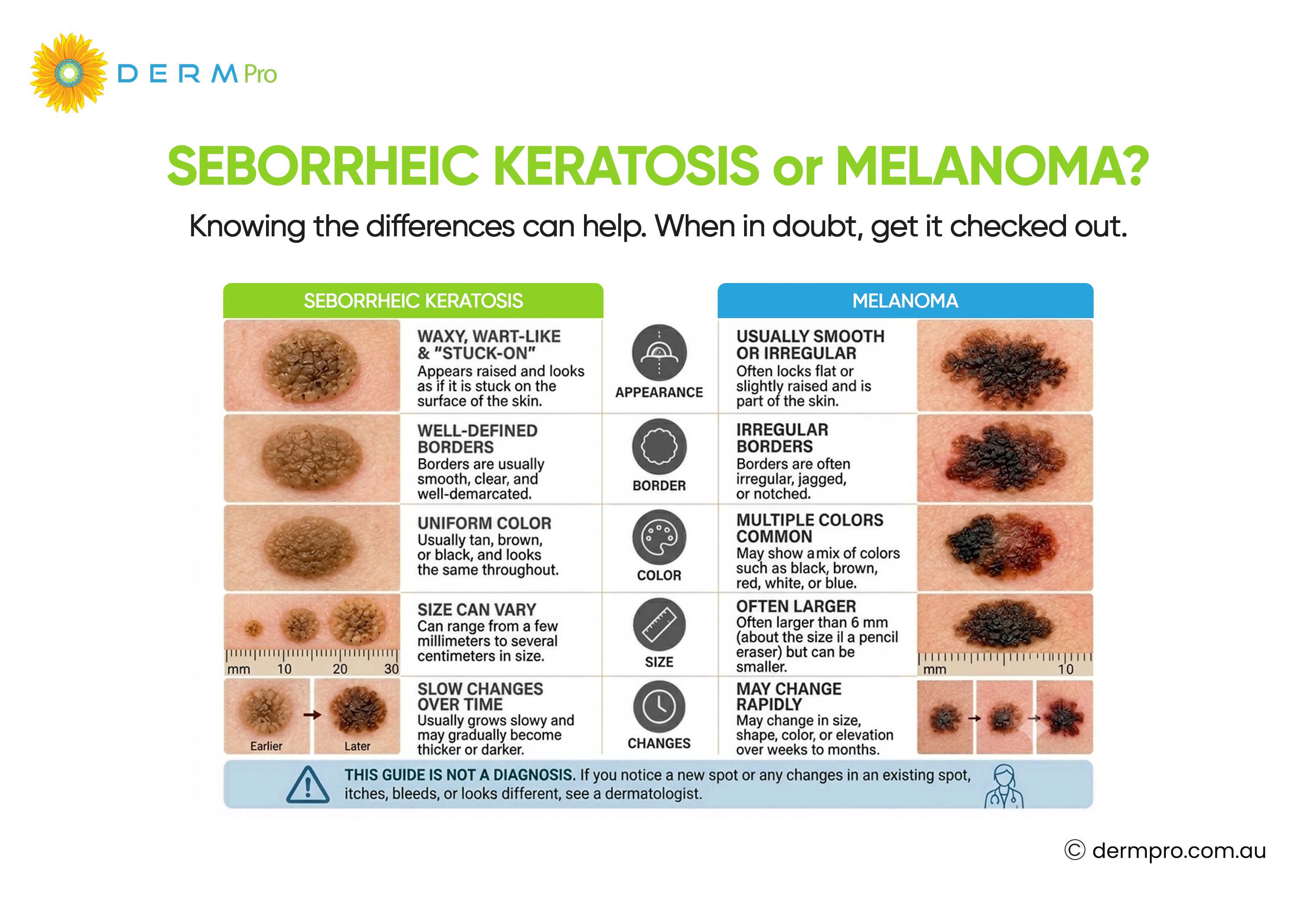 Seborrheic Keratosis or Melanoma?